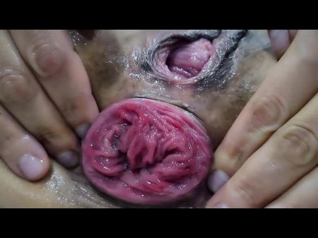 Going Knuckle Deep Buttfuck . Prolapse . Purchase Plan .